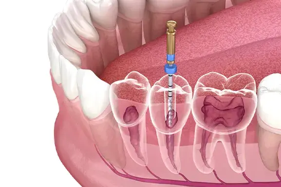 Endodontia